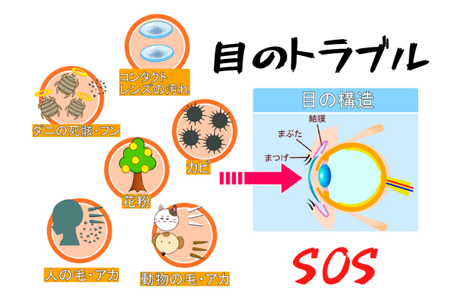 松江で目元ケアをしよう マツエクオフはまつ毛ダニ予防に 島根タンサック